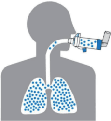 Lung deposition using an inhaler with AeroChamber